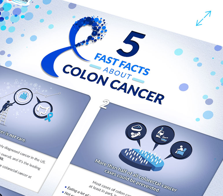 Colon Cancer: 5 Fast Facts Infographic